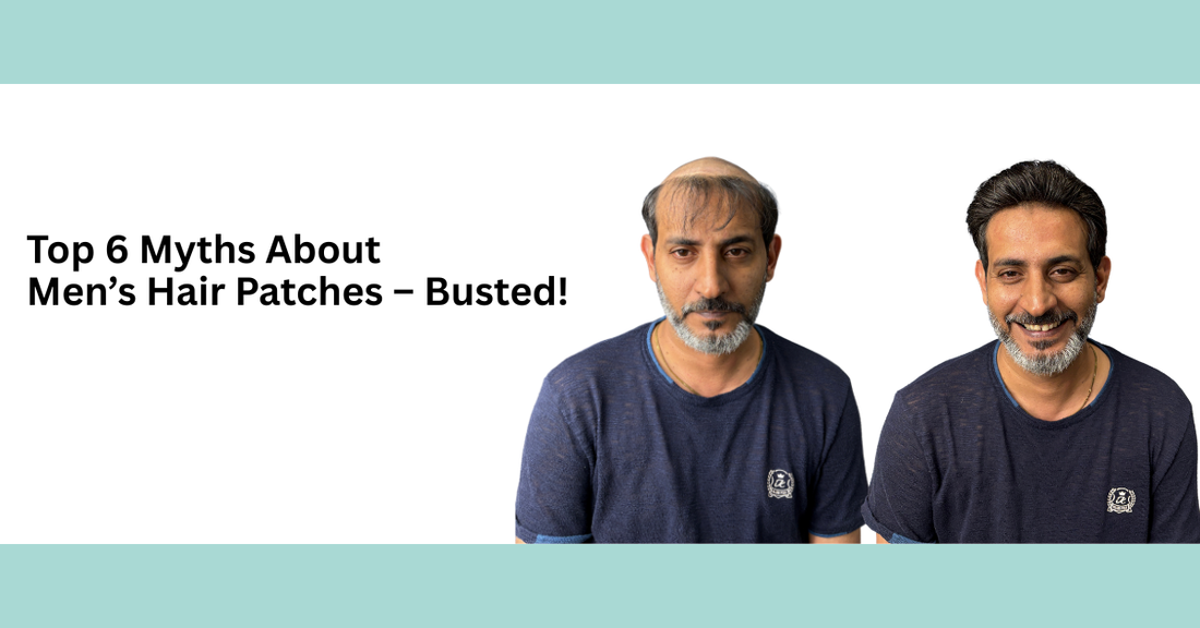 Top 6 Myths About Men’s Hair Patches – Busted!