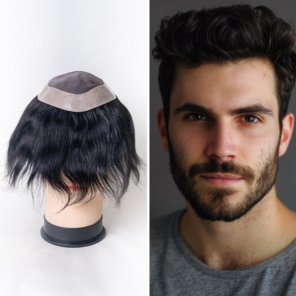 Los Angeles Hair Patch for Men by K-Hair India